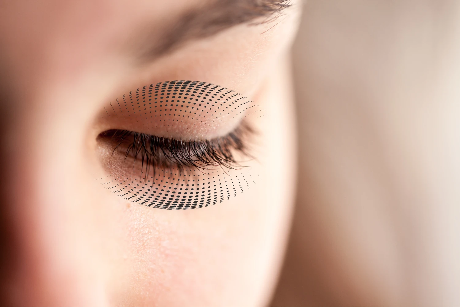 Prise en charge des Xanthélasmas par la technologie Plasma Plexr