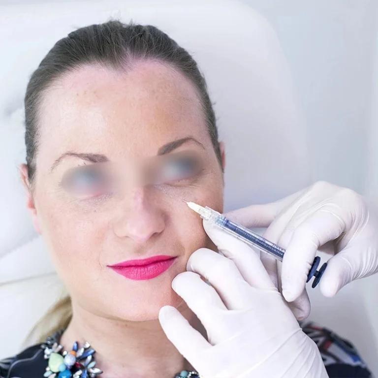 Injections-cerne-Centre-Esthetique-Lyon-dr-julien-vivier