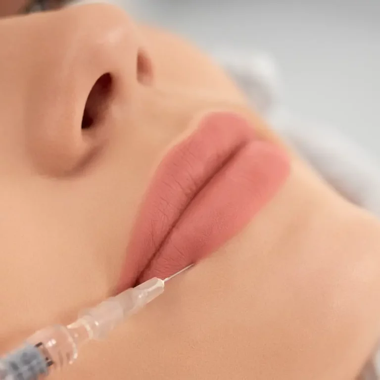injections des lèvres au cabinet du docteur julien vivier paris